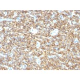 Immunohistochemistry - Anti-CD99 Antibody [HO36-1.1] - BSA and Azide free (A254326) - Antibodies.com