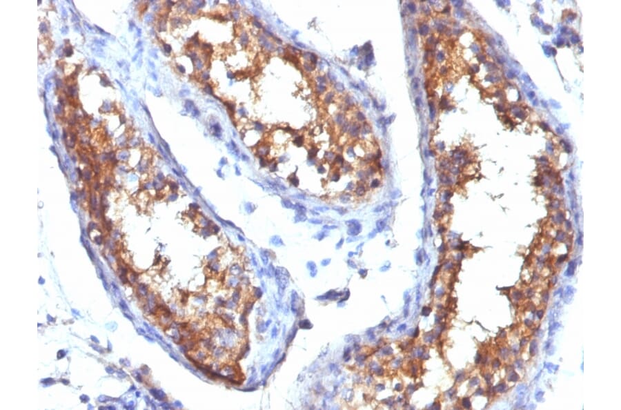 Immunohistochemistry - Anti-CD99 Antibody [HO36-1.1] - BSA and Azide free (A254327) - Antibodies.com