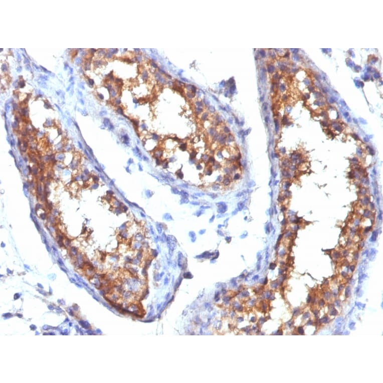 Immunohistochemistry - Anti-CD99 Antibody [HO36-1.1] - BSA and Azide free (A254327) - Antibodies.com