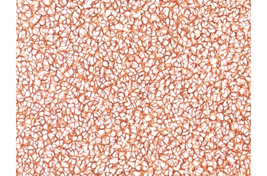 Immunohistochemistry - Anti-CD99 Antibody [SPM586] - BSA and Azide free (A254327) - Antibodies.com