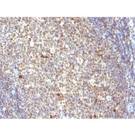 Immunohistochemistry - Anti-NuMA Antibody [SPM300] - BSA and Azide free (A254329) - Antibodies.com