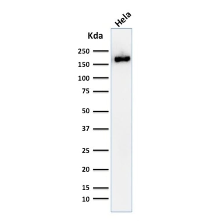 Western Blot - Anti-Podocalyxin Antibody [2A4] - BSA and Azide free (A254332) - Antibodies.com