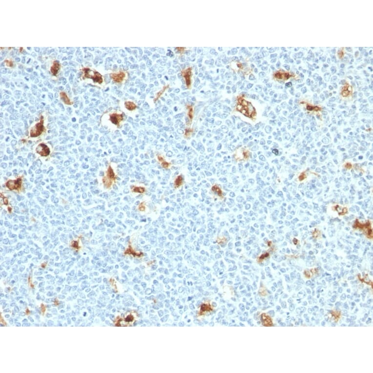 Immunohistochemistry - Anti-Calprotectin Antibody [S100A9/1011] - BSA and Azide free (A251057) - Antibodies.com