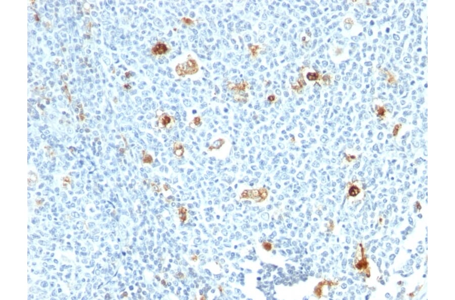 Immunohistochemistry - Anti-Calprotectin Antibody [CPT/1028] - BSA and Azide free (A251059) - Antibodies.com