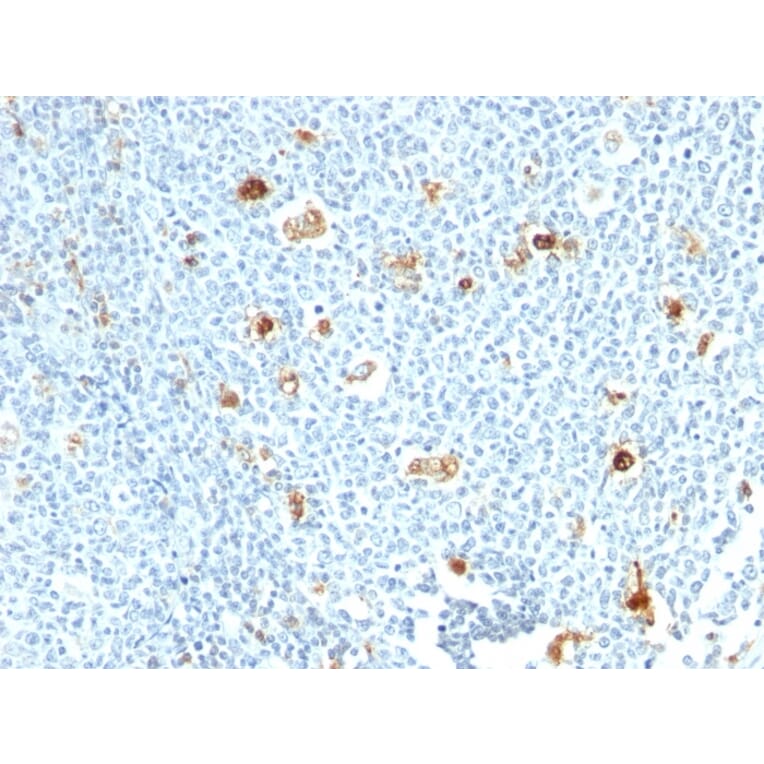 Immunohistochemistry - Anti-Calprotectin Antibody [CPT/1028] - BSA and Azide free (A251059) - Antibodies.com