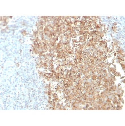 Immunohistochemistry - Anti-CDw75 Antibody [ZB55] - BSA and Azide free (A254339) - Antibodies.com