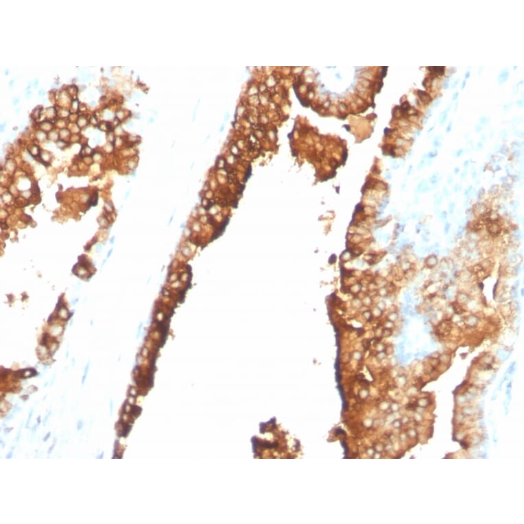 Immunohistochemistry - Anti-CDw75 Antibody [ZB55] - BSA and Azide free (A254338) - Antibodies.com