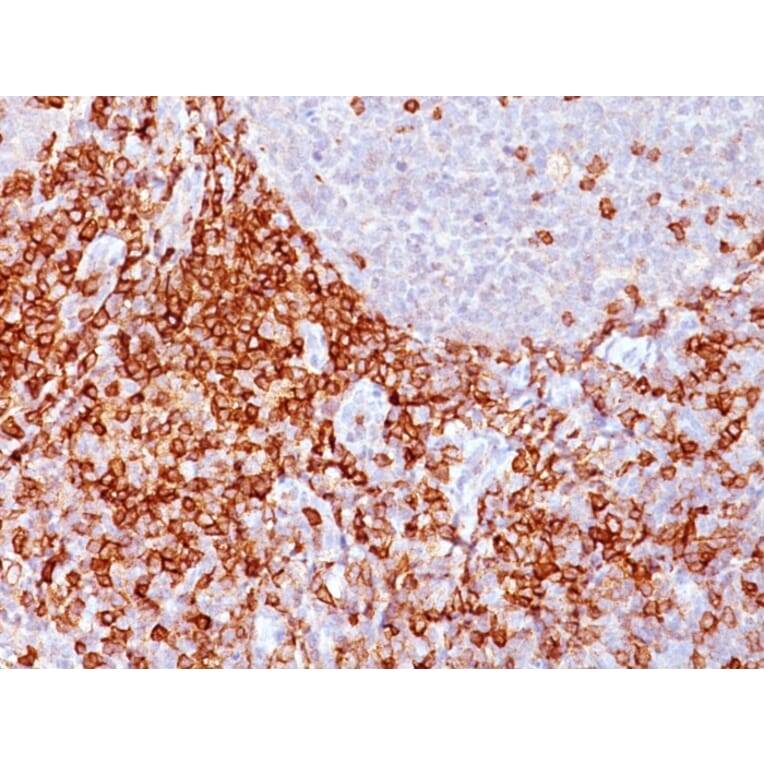 Immunohistochemistry - Anti-CD43 Antibody [Bra7G] - BSA and Azide free (A254341) - Antibodies.com