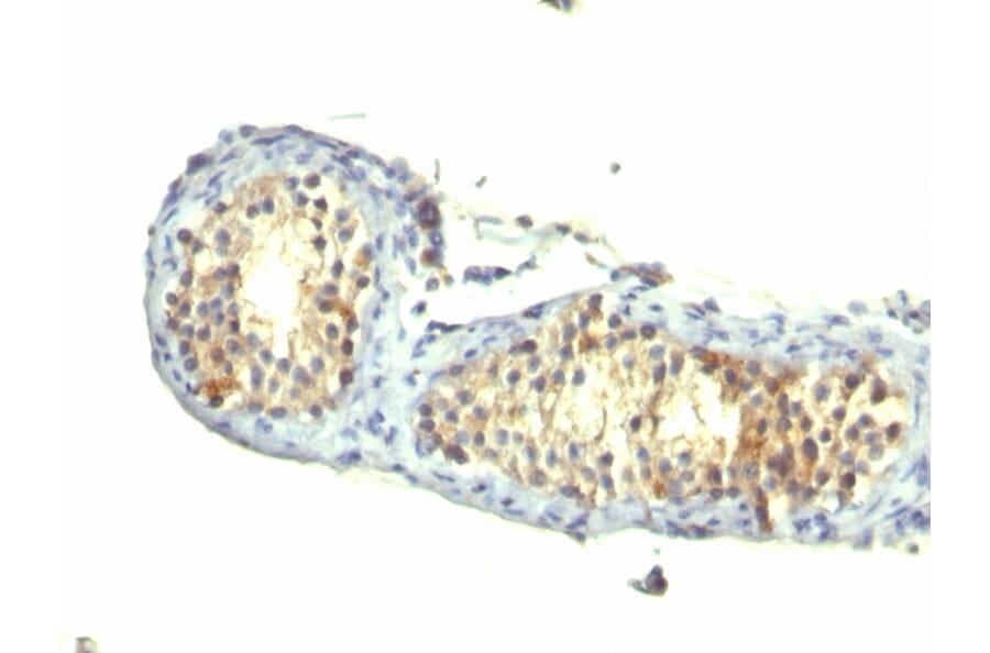 Immunohistochemistry - Anti-TGF alpha Antibody [1E8-G6] - BSA and Azide free (A254341) - Antibodies.com