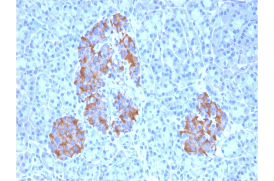 Immunohistochemistry - Anti-TNF alpha Antibody [TNFA/1172] - BSA and Azide free (A254346) - Antibodies.com