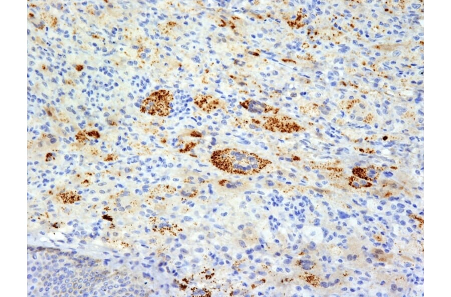 Immunohistochemistry - Anti-TNF alpha Antibody [TNFA/1172] - BSA and Azide free (A254346) - Antibodies.com