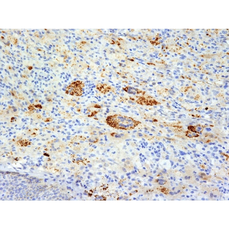 Immunohistochemistry - Anti-TNF alpha Antibody [TNFA/1172] - BSA and Azide free (A254346) - Antibodies.com