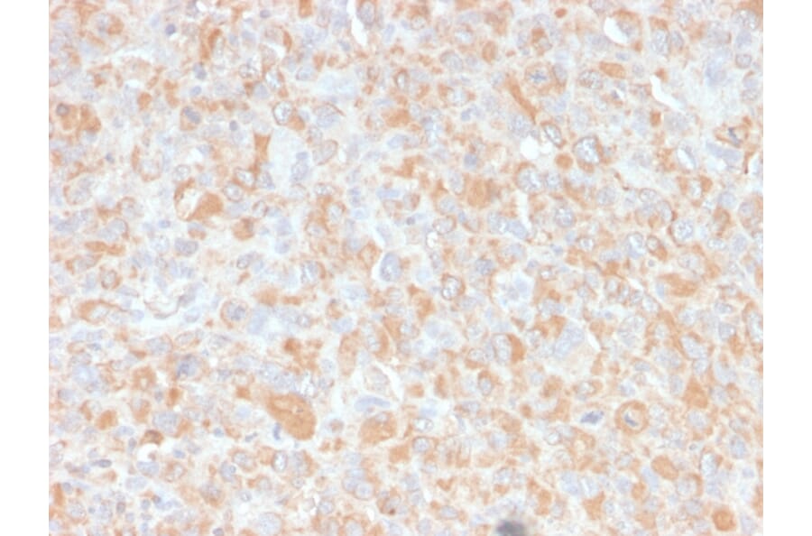 Immunohistochemistry - Anti-TNF alpha Antibody [4C6-H8] - BSA and Azide free (A254347) - Antibodies.com