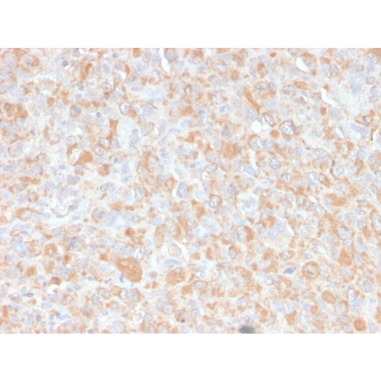 Immunohistochemistry - Anti-TNF alpha Antibody [4C6-H8] - BSA and Azide free (A254347) - Antibodies.com