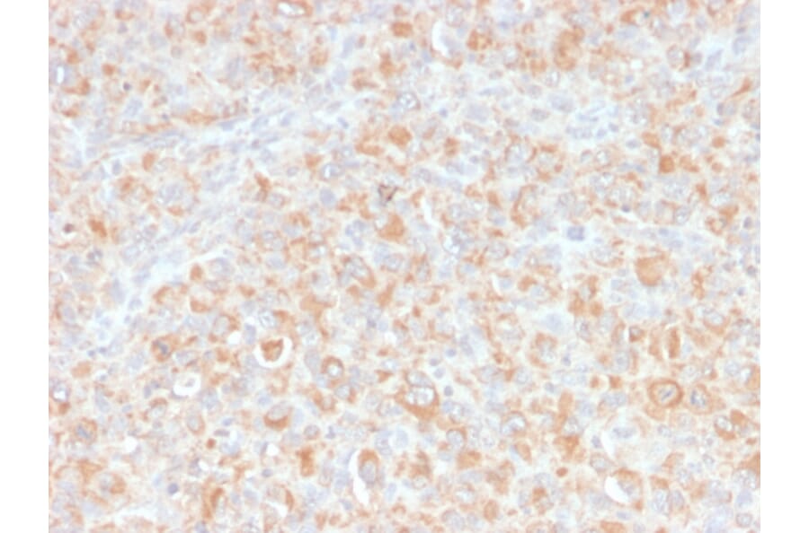 Immunohistochemistry - Anti-TNF alpha Antibody [SPM543] - BSA and Azide free (A254348) - Antibodies.com