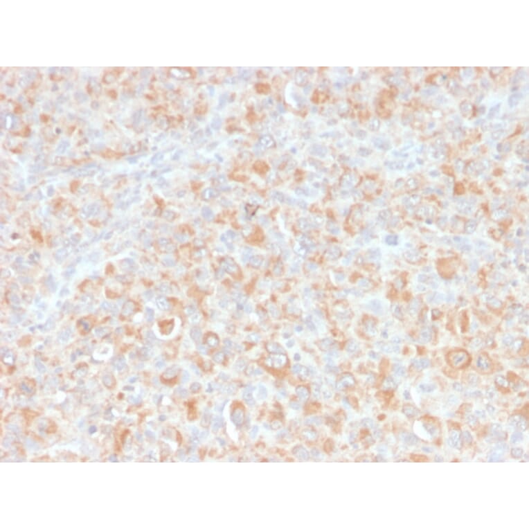 Immunohistochemistry - Anti-TNF alpha Antibody [SPM543] - BSA and Azide free (A254348) - Antibodies.com