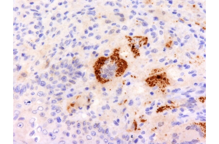 Immunohistochemistry - Anti-TNF alpha Antibody [P/T2] - BSA and Azide free (A254349) - Antibodies.com