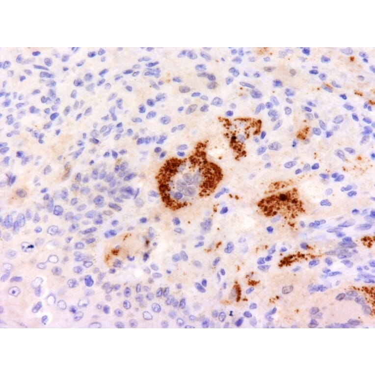 Immunohistochemistry - Anti-TNF alpha Antibody [P/T2] - BSA and Azide free (A254349) - Antibodies.com