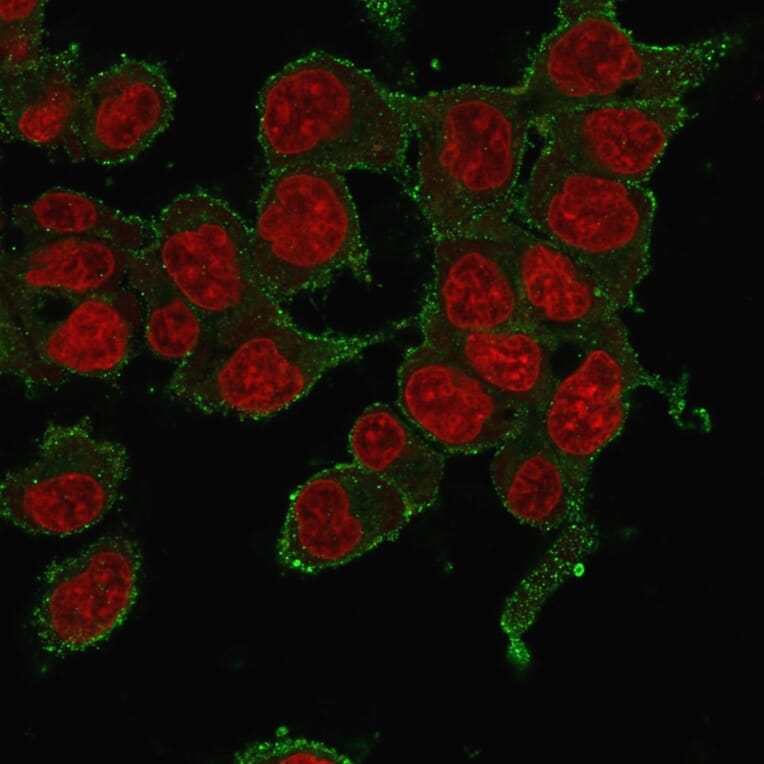 Immunofluorescence - Anti-TNF alpha Antibody [P/T2] - BSA and Azide free (A254348) - Antibodies.com