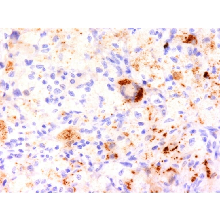 Immunohistochemistry - Anti-TNF alpha Antibody [TNF706] - BSA and Azide free (A254350) - Antibodies.com