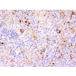 Immunohistochemistry - Anti-TNF alpha Antibody [TNF706 + P/T2] - BSA and Azide free (A254350) - Antibodies.com