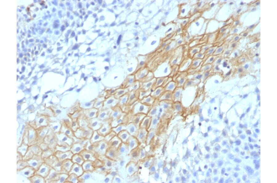 Immunohistochemistry - Anti-CD59 Antibody [MACIF/1193] - BSA and Azide free (A254356) - Antibodies.com