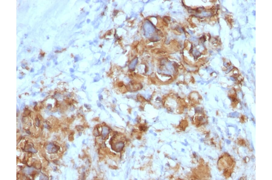 Immunohistochemistry - Anti-CA19-9 Antibody [121SLE] - BSA and Azide free (A254357) - Antibodies.com