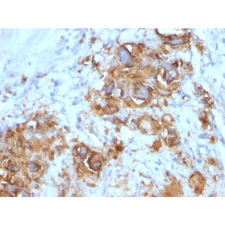 Immunohistochemistry - Anti-CA19-9 Antibody [121SLE] - BSA and Azide free (A254357) - Antibodies.com