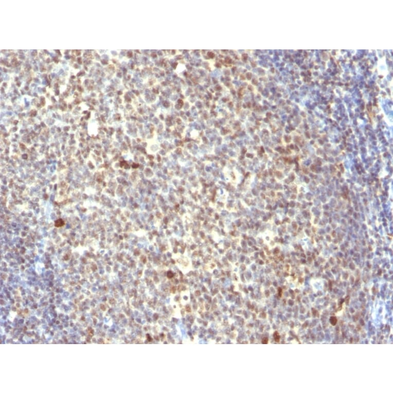 Immunohistochemistry - Anti-IPO-38 Antibody [IPO-38] - BSA and Azide free (A251088) - Antibodies.com