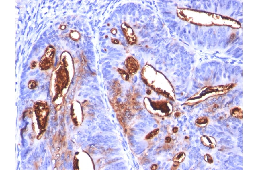 Immunohistochemistry - Anti-CA19-9 Antibody [SPM588] - BSA and Azide free (A254366) - Antibodies.com