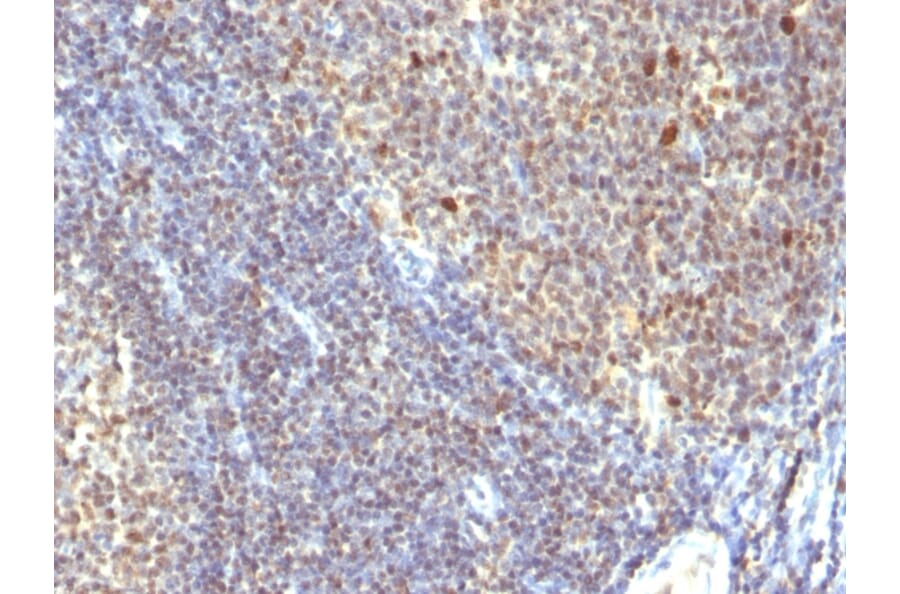 Immunohistochemistry - Anti-IPO-38 Antibody [SPM260] - BSA and Azide free (A254367) - Antibodies.com