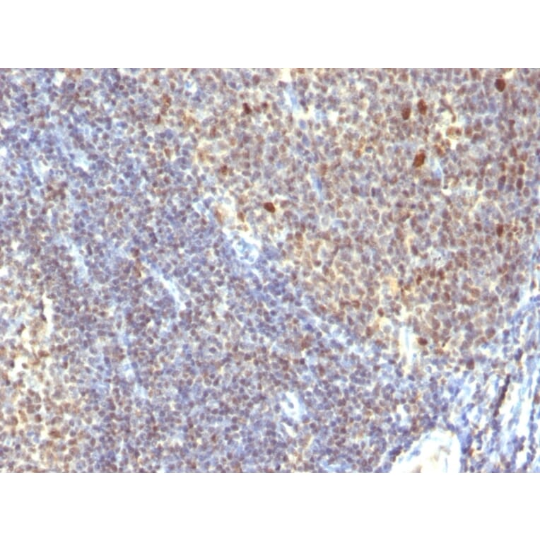 Immunohistochemistry - Anti-IPO-38 Antibody [SPM260] - BSA and Azide free (A254367) - Antibodies.com
