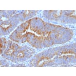 Immunohistochemistry - Anti-Thomsen-Friedenreich Antigen Antibody [SPM320] - BSA and Azide free (A254368) - Antibodies.com