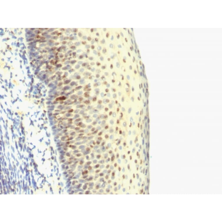 Immunohistochemistry - Anti-IPO-38 Antibody [SPM515] - BSA and Azide free (A251093) - Antibodies.com