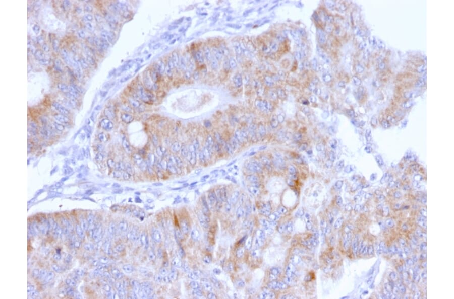 Immunohistochemistry - Anti-Thomsen-Friedenreich Antigen Antibody [A63-C/A9] - BSA and Azide free (A254370) - Antibodies.com