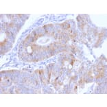 Immunohistochemistry - Anti-Thomsen-Friedenreich Antigen Antibody [A63-C/A9] - BSA and Azide free (A254370) - Antibodies.com