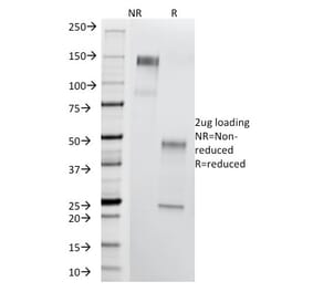 SDS-PAGE - Anti-Thomsen-Friedenreich Antigen Antibody [A84-A/F10] - BSA and Azide free (A254375) - Antibodies.com