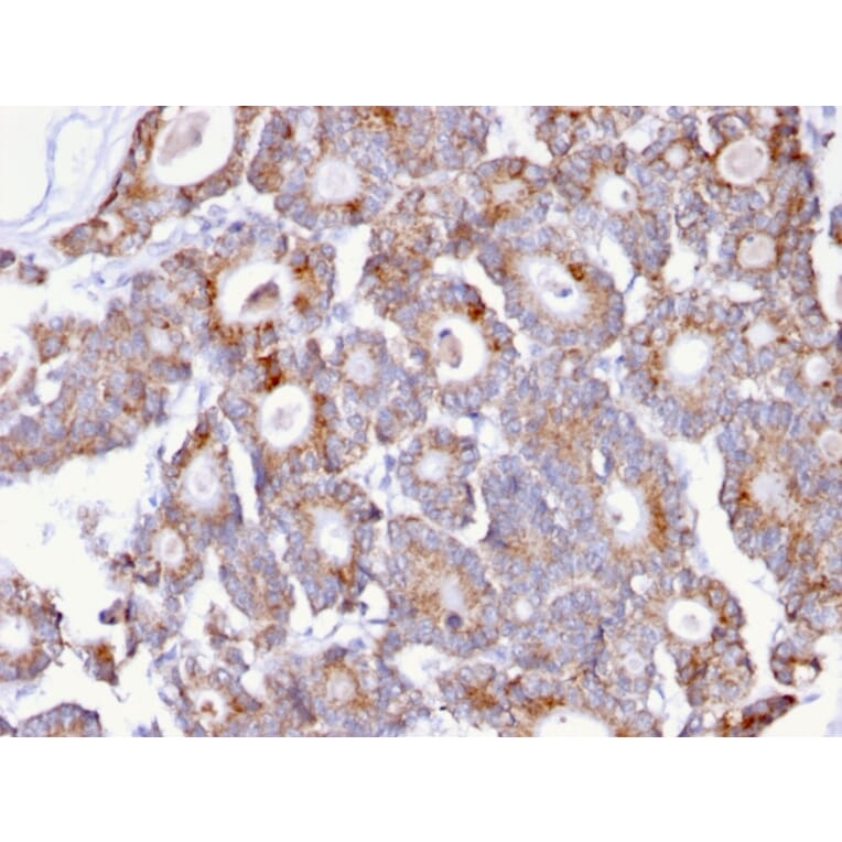 Immunohistochemistry - Anti-Thomsen-Friedenreich Antigen Antibody [A84-A/F10] - BSA and Azide free (A254375) - Antibodies.com