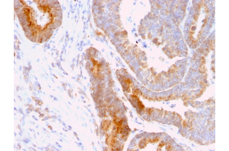 Immunohistochemistry - Anti-Thomsen-Friedenreich Antigen Antibody [A84-A/F10] - BSA and Azide free (A254374) - Antibodies.com