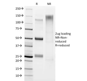 SDS-PAGE - Anti-Helicobacter pylori Antibody [HP/1336] - BSA and Azide free (A254375) - Antibodies.com