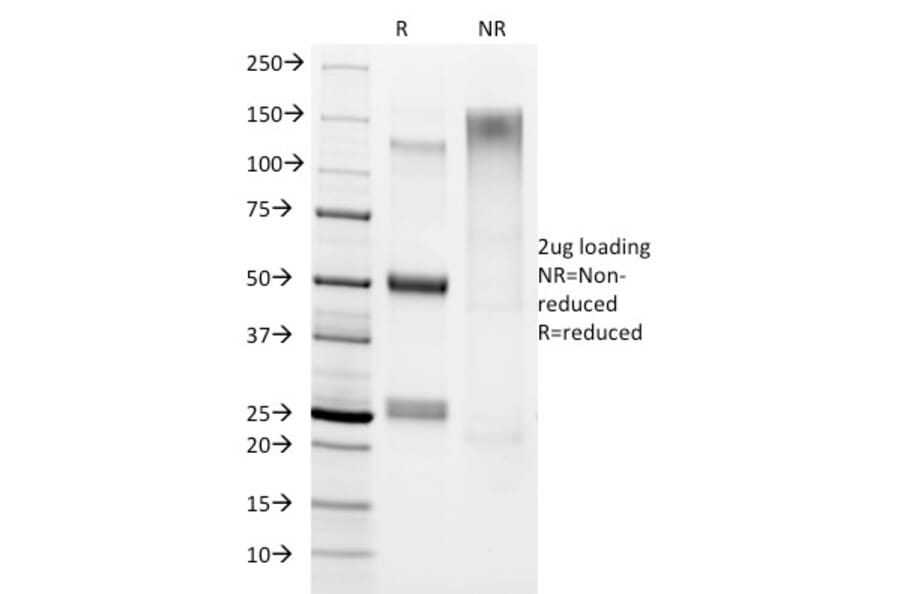 SDS-PAGE - Anti-Helicobacter pylori Antibody [HP/1336] - BSA and Azide free (A254375) - Antibodies.com
