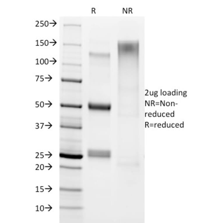 SDS-PAGE - Anti-Helicobacter pylori Antibody [HP/1336] - BSA and Azide free (A254375) - Antibodies.com