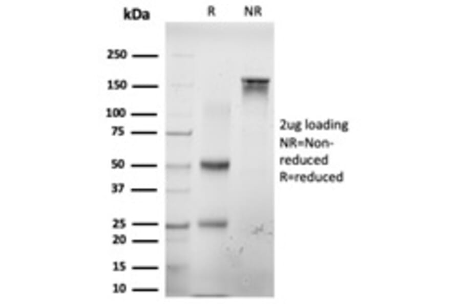SDS-PAGE - Anti-E2F6 Antibody [PCRP-E2F6-1F8] (A254378) - Antibodies.com