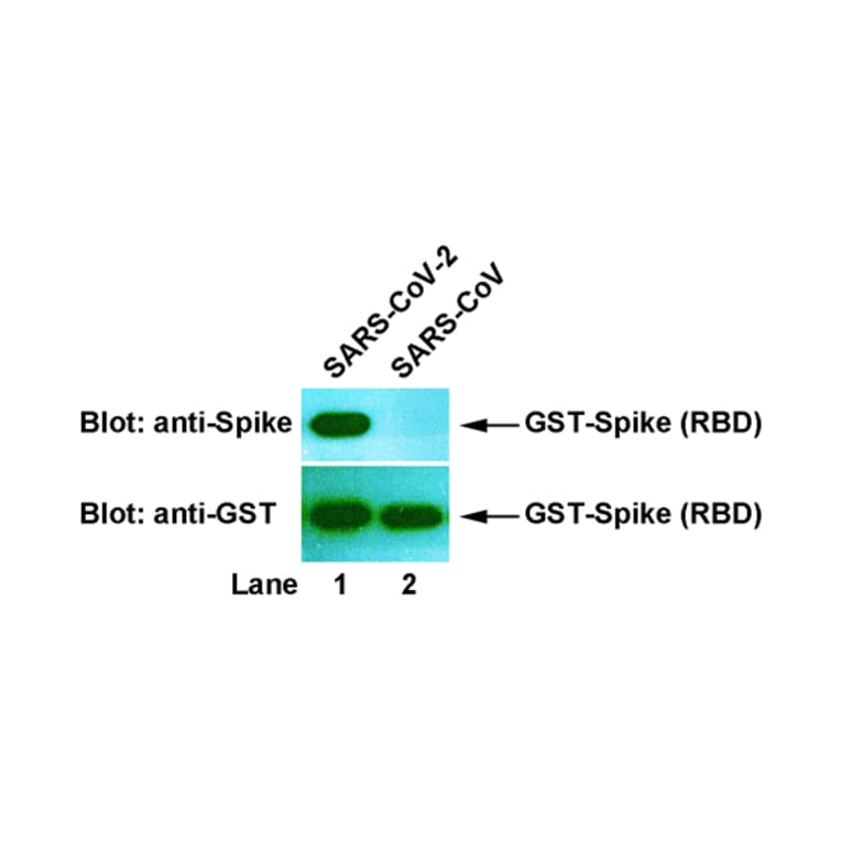 Western Blot - Anti-SARS-CoV-2 Spike Protein Antibody [8E2] (A254382) - Antibodies.com