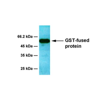 Western Blot - Anti-GST Antibody [6D5] (A254384) - Antibodies.com