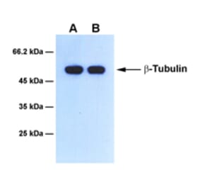 Western Blot - Anti-beta Tubulin Antibody [2F4] (A254392) - Antibodies.com