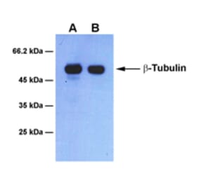Western Blot - Anti-beta Tubulin Antibody [1B6] (A254393) - Antibodies.com