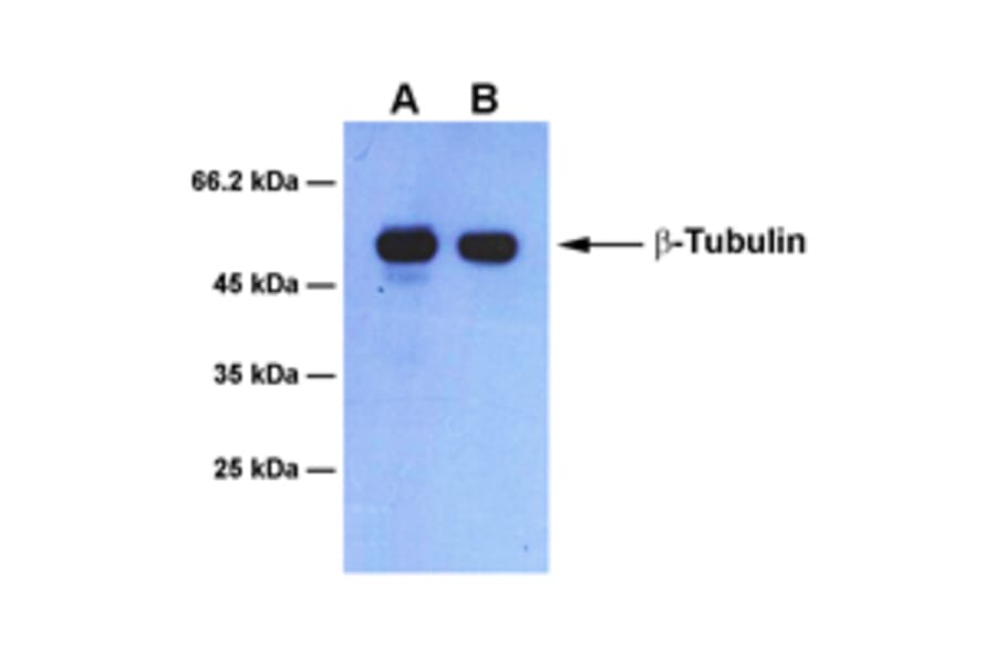 Western Blot - Anti-beta Tubulin Antibody [1B6] (A254393) - Antibodies.com