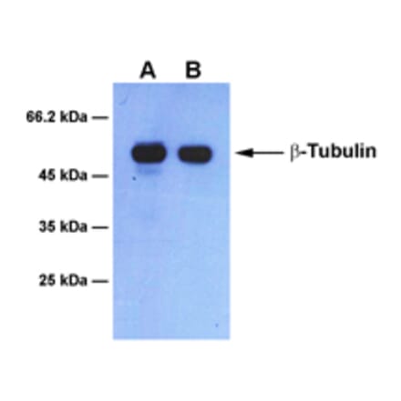 Western Blot - Anti-beta Tubulin Antibody [1B6] (A254393) - Antibodies.com