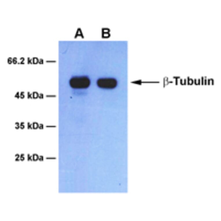 Western Blot - Anti-beta Tubulin Antibody [1B6] (A254393) - Antibodies.com